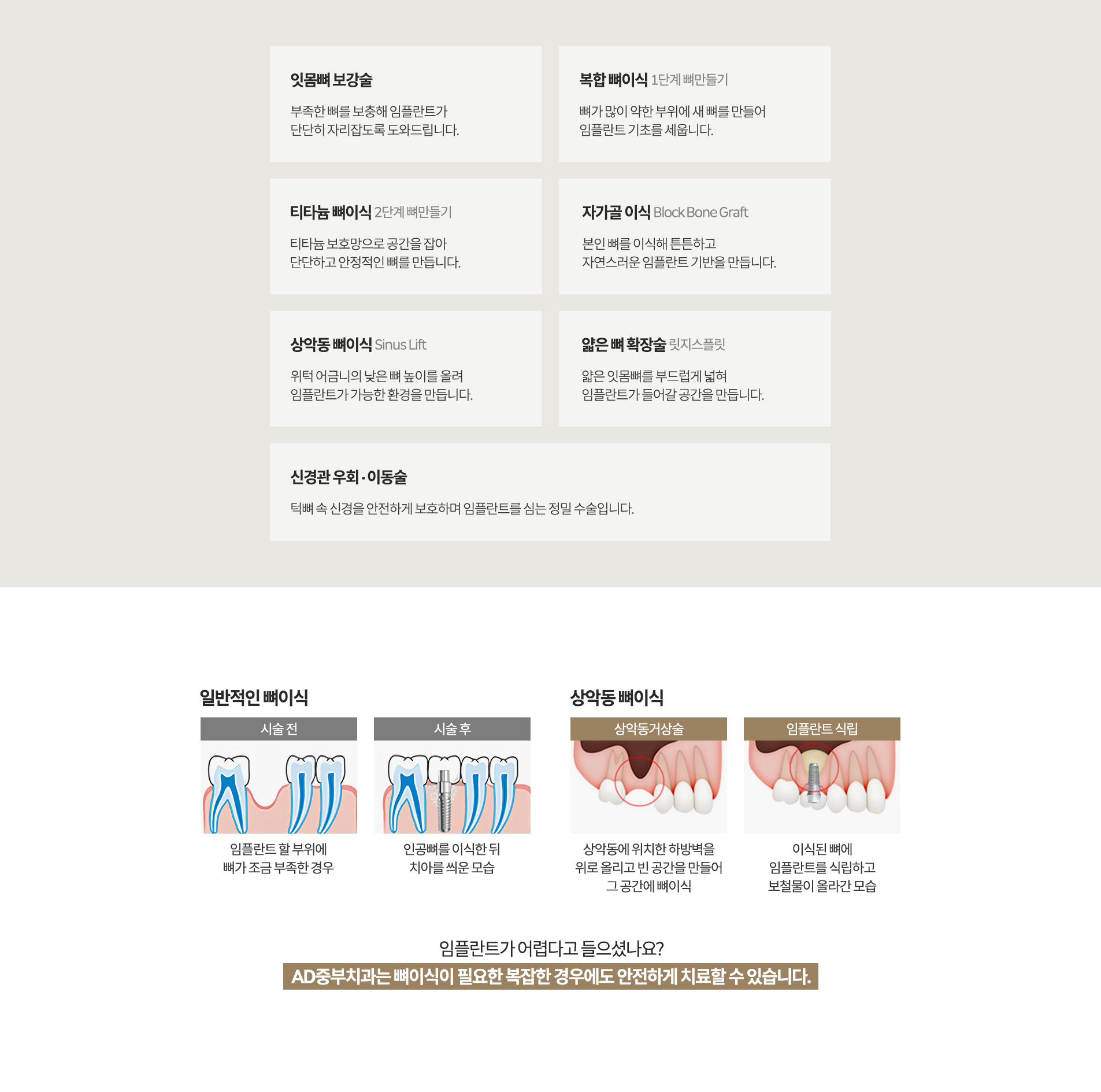AD중부치과의특별함_09